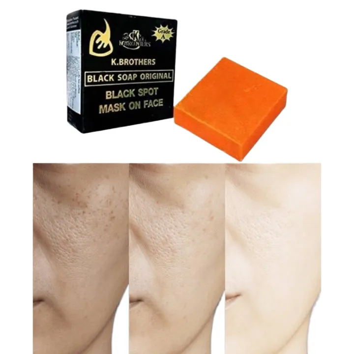 K.BROTHERS Black Soap Original Black Spot Mask | Deep Cleansing Face Soap | Skin Brightening Soap - Image 5